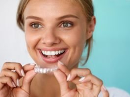 Invisalign for Underbites and Overbites
