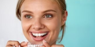 Invisalign for Underbites and Overbites