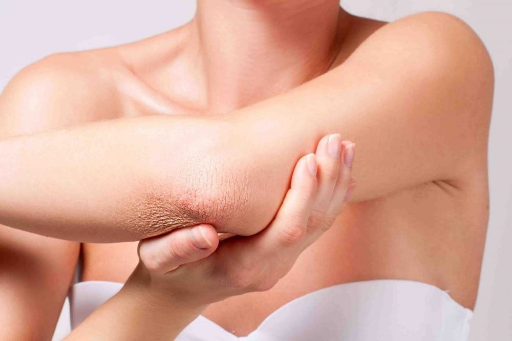 What is the skin on your elbow called