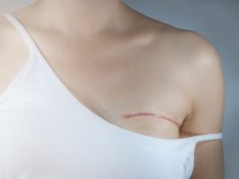 How To Regain Your Confidence After A Mastectomy
