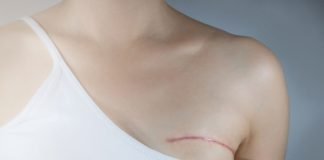 How To Regain Your Confidence After A Mastectomy