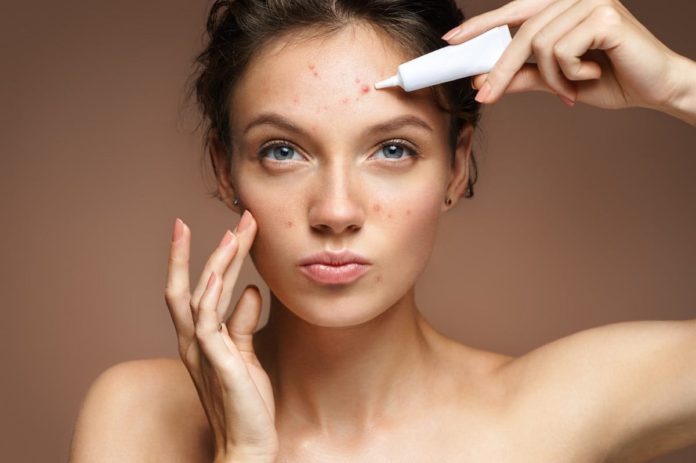 How to Handle Post-Workout Acne