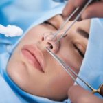 Why You Should Get A Nose Surgery