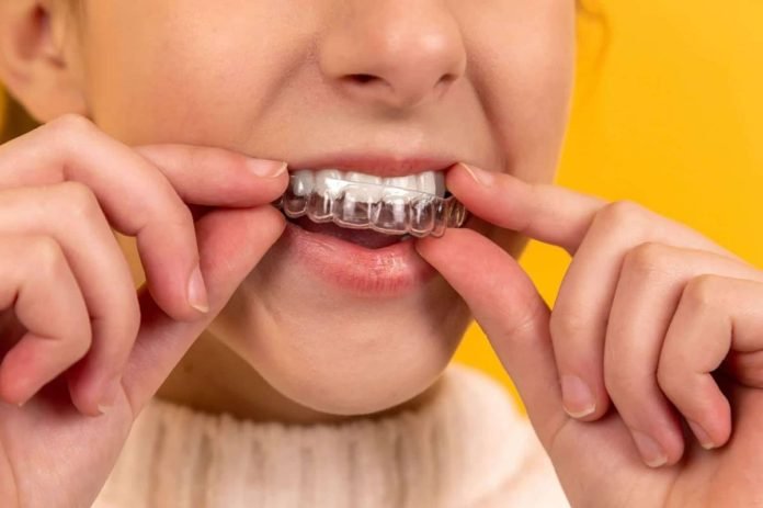 Types of Temporary Teeth Covers and Their Benefits