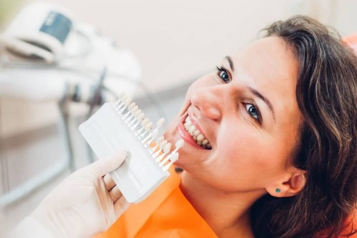 Ways Dental Veneers Will Impact Your Social Life