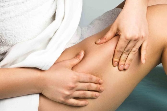 How To Reduce Your Cellulite At Home