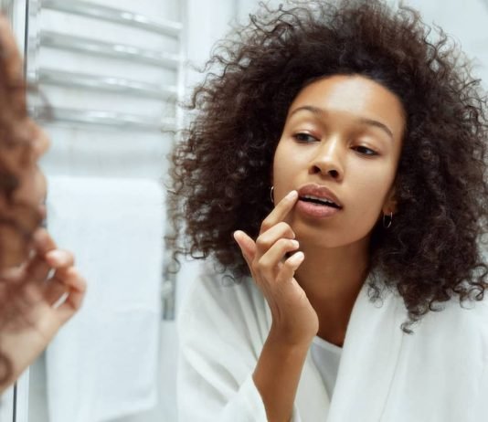 How To Get Rid Of Fordyce Spots On Lips
