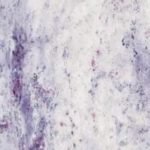 Low Grade Squamous Intraepithelial Lesion