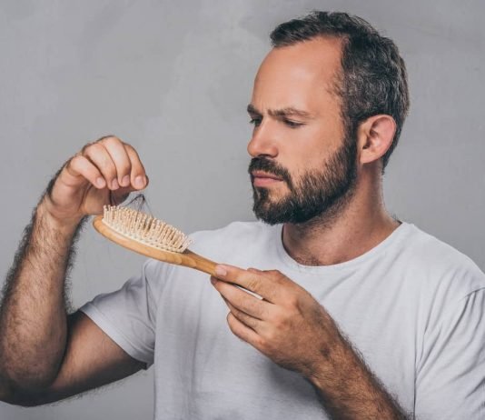 Understanding Male Hair Loss