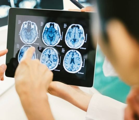 Brain tumor prognosis